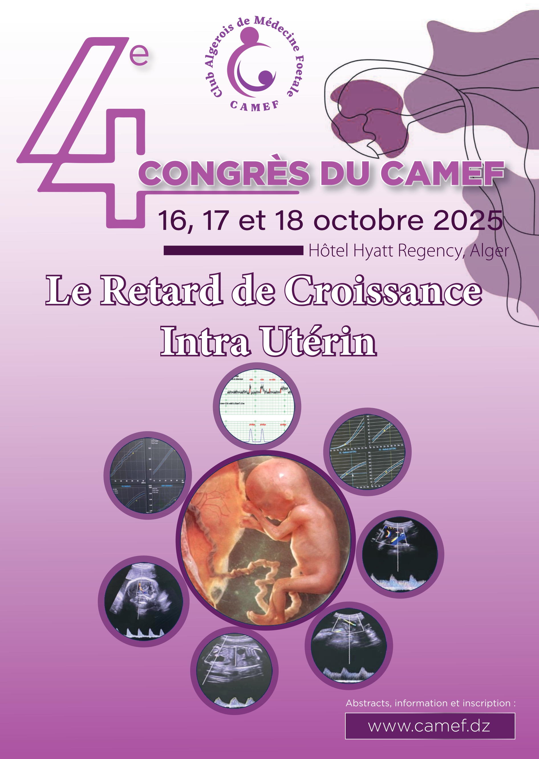 4ème Congrès CAMEF 2025 - Le Retard de Croissance Intra Utérin